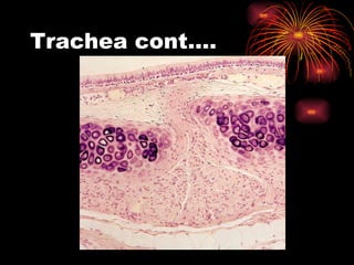 Trachea cont…. 