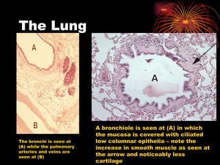 The Lung The bronchi is seen at (A) while the pulmonary arteries and veins are seen at (B) A bronchiole is seen at (A) in which the mucosa is covered with ciliated low columnar epithelia – note the increase in smooth muscle as seen at the arrow and noticeably less cartilage 