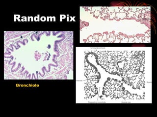 Random Pix Bronchiole 