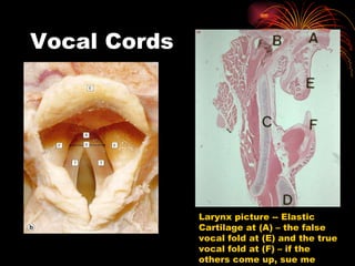 Vocal Cords Larynx picture -- Elastic Cartilage at (A) – the false vocal fold at (E) and the true vocal fold at (F) – if the others come up, sue me 
