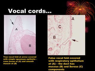 Vocal cords… True vocal fold at arrow covered with simple squamous epithelia – conn tissue at (A) and smooth muscle at (B) False vocal fold covered with respiratory epithelium at (A) – the duct has mucous (B) and Serous (C) components 