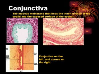 Conjunctiva The mucous membrane that lines the inner surface of the eyelid and the exposed surface of the eyeball. Conjuntiva on the left, and cornea on the right 