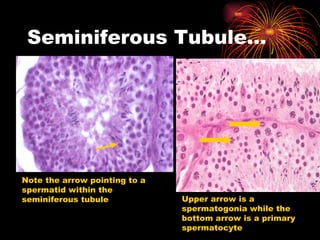 Seminiferous Tubule… Note the arrow pointing to a spermatid within the seminiferous tubule Upper arrow is a spermatogonia while the bottom arrow is a primary spermatocyte 