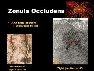 Zonula Occludens AKA tight junctions Seal around the cell Left picture -- #2 Right Picture - #1 Tight junction at #3 