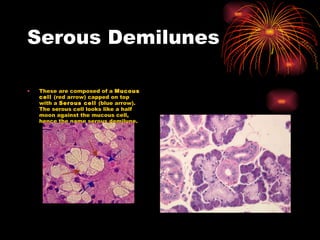 Serous Demilunes These are composed of a  Mucous cell  (red arrow) capped on top with a  Serous cell  (blue arrow). The serous cell looks like a half moon against the mucous cell, hence the name serous demilune.  