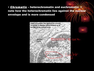 Chromatin  – heterochromatin and euchromatin    note how the heterochromatin lies against the nuclear envelope and is more condensed 