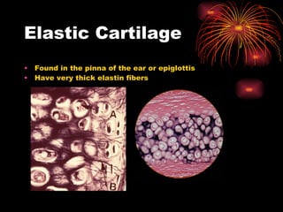 Elastic Cartilage Found in the pinna of the ear or epiglottis Have very thick elastin fibers 