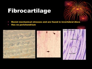 Fibrocartilage Resist mechanical stresses and are found in invertebral discs Has no perichondrium 