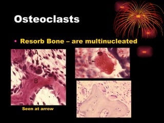 Osteoclasts Resorb Bone – are multinucleated Seen at arrow 