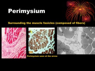 Perimysium Surrounding the muscle fasicles (composed of fibers) Perimysium seen at the arrow 