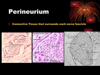 Perineurium Connective Tissue that surrounds each nerve fascicle 
