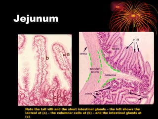 Jejunum Note the tall villi and the short intestinal glands – the left shows the lacteal at (a) – the columnar cells at (b) – and the intestinal glands at (c) 