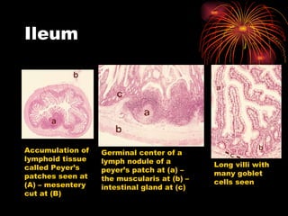 Ileum Accumulation of lymphoid tissue called Peyer’s patches seen at (A) – mesentery cut at (B) Germinal center of a lymph nodule of a peyer’s patch at (a) – the muscularis at (b) – intestinal gland at (c) Long villi with many goblet cells seen 
