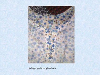 Kelepet pada tengkuk baju
 