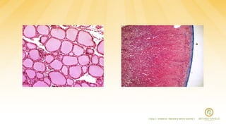 [ Slide 3 - SURRENE, TIROIDE E METILAZIONE ]
 