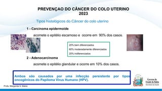 PREVENÇAO DO CÂNCER DO COLO UTERINO
2023
Tipos histológicos do Câncer do colo uterino
1 - Carcinoma epidermoide
acomete o epitélio escamoso e ocorre em 90% dos casos.
2 - Adenocarcinoma
acomete o epitélio glandular e ocorre em 10% dos casos.
Ambos são causados por uma infecção persistente por tipos
oncogênicos do Papiloma Vírus Humano (HPV).
20% bem diferenciados
60% moderadamente diferenciados
20% indiferenciados
Profa. Margarida S. Matos
 