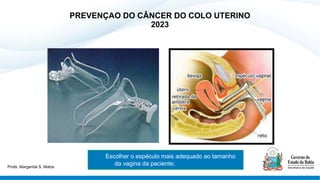 PREVENÇAO DO CÂNCER DO COLO UTERINO
2023
Escolher o espéculo mais adequado ao tamanho
da vagina da paciente;
Profa. Margarida S. Matos
 