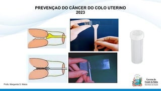 PREVENÇAO DO CÂNCER DO COLO UTERINO
2023
Profa. Margarida S. Matos
 