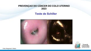 Teste de Schiller
PREVENÇAO DO CÂNCER DO COLO UTERINO
2023
Profa. Margarida S. Matos
 