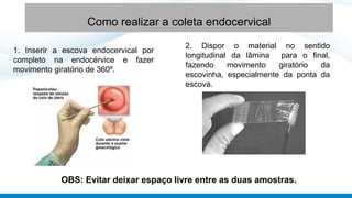 Como realizar a coleta endocervical
1. Inserir a escova endocervical por
completo na endocérvice e fazer
movimento giratório de 360º.
2. Dispor o material no sentido
longitudinal da lâmina para o final,
fazendo movimento giratório da
escovinha, especialmente da ponta da
escova.
OBS: Evitar deixar espaço livre entre as duas amostras.
 