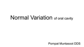 Normal Variation of oral cavity
Pornpat Muntasoot DDS
 