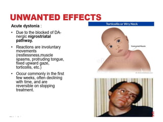  Anti psychotics