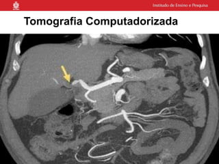 Tomografia Computadorizada
 