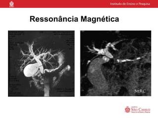 Ressonância Magnética
 