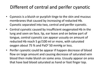 Different of central and perifer cyanotic
• Cyanosis is a bluish or purplish tinge to the skin and mucous
membranes that caused by increasing of reducted Hb.
Cyanotic separated into two, central and perifer cyanotic.
• Central cyanotic caused by insufficient oxygenated Hb in the
lung and seen on face, lip, ear leave and on below part of
tongue, central cyanotic can appear ussualy on amount of
reducted Hb reach 5 gr/100 ml or more, with saturated
oxygen about 75 % and PaO2 50 mmHg or less.
• Perifer cyanotic could be appear if happen decrease of blood
flow on large amount and causing decrease of saturated vein
blood then make bluish on some area. Ussualy appear on area
that have bad blood saturated as hand or foot finger top.
 