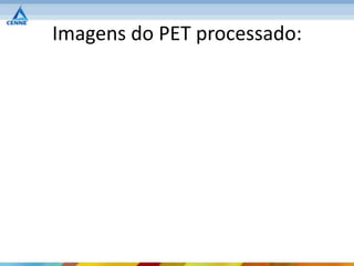Imagens do PET processado:
 