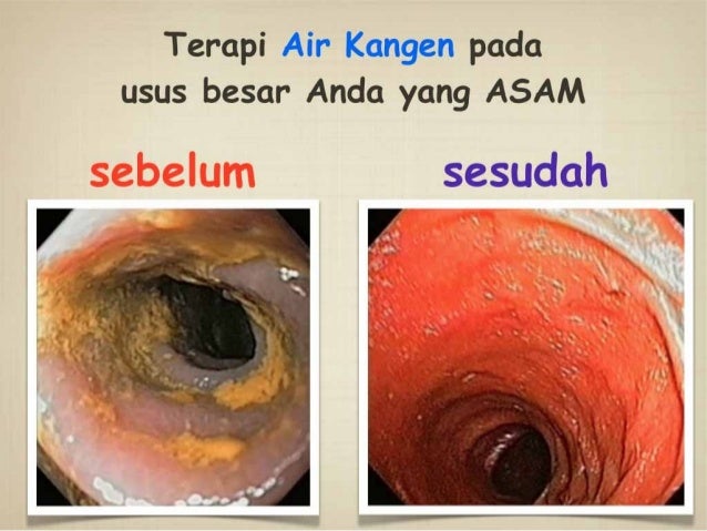 Download Presentasi Kangen Water