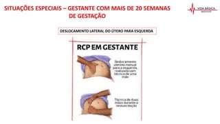 SITUAÇÕES ESPECIAIS – GESTANTE COM MAIS DE 20 SEMANAS
DE GESTAÇÃO
DESLOCAMENTO LATERAL DO ÚTERO PARA ESQUERDA
 