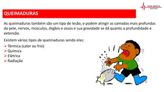 QUEIMADURAS
As queimaduras também são um tipo de lesão, e podem atingir as camadas mais profundas
da pele, nervos, músculos, órgãos e ossos e sua gravidade se dá quanto a profundidade e
extensão.
Existem vários tipos de queimaduras sendo elas:
Térmica (calor ou frio)
Química
Elétrica
Radiação
 