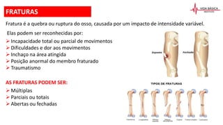 Fratura é a quebra ou ruptura do osso, causada por um impacto de intensidade variável.
Elas podem ser reconhecidas por:
Incapacidade total ou parcial de movimentos
Dificuldades e dor aos movimentos
Inchaço na área atingida
Posição anormal do membro fraturado
Traumatismo
AS FRATURAS PODEM SER:
Múltiplas
Parciais ou totais
Abertas ou fechadas
FRATURAS
 