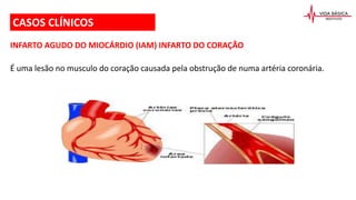 CASOS CLÍNICOS
INFARTO AGUDO DO MIOCÁRDIO (IAM) INFARTO DO CORAÇÃO
É uma lesão no musculo do coração causada pela obstrução de numa artéria coronária.
 