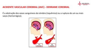 ACIDENTE VASCULAR CEREBRAL (AVC) - DERRAME CEREBRAL
É a obstrução dos vasos sanguíneos do cérebro (isquêmico) ou a ruptura de um ou mais
vasos (hemorrágico).
 