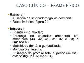 • Extraoral:
 Ausência de linfonodomegalias cervicais;
 Face simétrica (figura 01).
• Intraoral:
 Edentulismo maxilar;
 Presença de unidades anteriores em
mandíbula (43, 42, 41, 31, 32 e 33) e
unidade 48;
 Mobilidade dentária generalizada;
 Mucosa oral íntegra;
 Utilização de prótese total superior em mau
estado (figuras 02, 03 e 04).
 