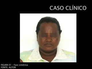 FIGURA 01 – Face simétrica
FONTE: AUTOR
 