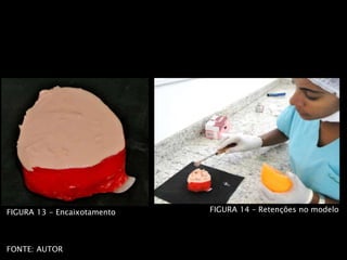 FIGURA 13 - Encaixotamento
FONTE: AUTOR
FIGURA 10
FIGURA 14 – Retenções no modelo
 