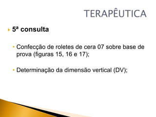  5ª consulta
• Confecção de roletes de cera 07 sobre base de
prova (figuras 15, 16 e 17);
• Determinação da dimensão vertical (DV);
 