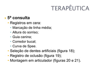  5ª consulta
• Registros em cera:
• Marcação de linha média;
• Altura do sorriso;
• Guia canina;
• Corredor bucal;
• Curva de Spee.
• Seleção de dentes artificiais (figura 18);
• Registro de oclusão (figura 19);
• Montagem em articulador (figuras 20 e 21).
 