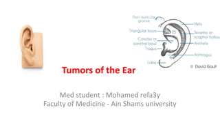 common middle ear tumors | PDF