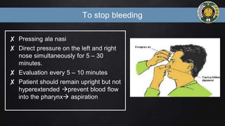 To stop bleeding
✘ Pressing ala nasi
✘ Direct pressure on the left and right
nose simultaneously for 5 – 30
minutes.
✘ Evaluation every 5 – 10 minutes
✘ Patient should remain upright but not
hyperextended prevent blood flow
into the pharynx aspiration
 