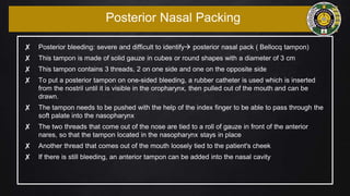 ✘ Posterior bleeding: severe and difficult to identify posterior nasal pack ( Bellocq tampon)
✘ This tampon is made of solid gauze in cubes or round shapes with a diameter of 3 cm
✘ This tampon contains 3 threads, 2 on one side and one on the opposite side
✘ To put a posterior tampon on one-sided bleeding, a rubber catheter is used which is inserted
from the nostril until it is visible in the oropharynx, then pulled out of the mouth and can be
drawn.
✘ The tampon needs to be pushed with the help of the index finger to be able to pass through the
soft palate into the nasopharynx
✘ The two threads that come out of the nose are tied to a roll of gauze in front of the anterior
nares, so that the tampon located in the nasopharynx stays in place
✘ Another thread that comes out of the mouth loosely tied to the patient's cheek
✘ If there is still bleeding, an anterior tampon can be added into the nasal cavity
Posterior Nasal Packing
 