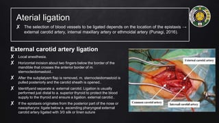 Aterial ligation
✘ The selection of blood vessels to be ligated depends on the location of the epistaxis →
external carotid artery, internal maxillary artery or ethmoidal artery (Punagi, 2016).
External carotid artery ligation
✘ Local anesthesia.
✘ Horizontal incision about two fingers below the border of the
mandible that crosses the anterior border of m.
sternocleidomastoid..
✘ After the subplatysm flap is removed, m. sternocleidomastoid is
pulled posteriorly and the carotid sheath is opened..
✘ Identifyand separate a. external carotid. Ligation is usually
performed just distal to a. superior thyroid to protect the blood
supply to the thyroid and ensure a ligation. external carotid..
✘ If the epistaxis originates from the posterior part of the nose or
nasopharynx: ligate below a. ascending pharyngeal external
carotid artery ligated with 3/0 silk or linen suture
 