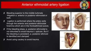 Anterior ethmoidal artery ligation
✘ Bleeding superior to the middle turbinate
ligation a. anterior or posterior ethmoidal or
both.
✘ Ligation is performed where the artery exits
through the anterior and posterior ethmoidal
foramina which are in the frontoethmoid suture.
✘ If the bleeding stops, a. posterior ethmoidal is
not disturbed to avoid trauma n. optician. But if
the bleeding is persistent, a. posterior ethmoid
is identified and clamped
✘ Avoid using cautery to avoid trauma.
 