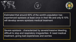 Estimated that around 60% of the world's population has
experienced epistaxis at least once in their life and only 6-10%
will develop severe epistaxis medical treatment
Severe epistaxis : characterized by severe/massive bleeding,
difficult to stop and respiratory irregularities  need medical
treatment, giving bad experiences and worries
 