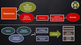 Emergency
Severe,
difficult to
control (rare)
Epistaxsis
Mild,
spontaneous
stop/simple
manuever
Aspiration
pneumonia, anemia,
hypovolemic shock
Mortality
History
Physical
examination
Supporting
investigation
Finding the
source of bleeding
Find the cause
that finds
Stop the bleeding
prevent
complications
Prevents
recurrent
epistaxis
Treatment
 