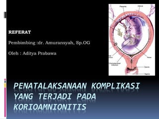 PENATALAKSANAAN KOMPLIKASI
YANG TERJADI PADA
KORIOAMNIONITIS
REFERAT
Pembimbing :dr. Amuransyah, Sp.OG
Oleh : Aditya Prabawa
 