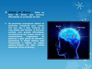  Afasia de Broca : Dano na
área de Broca que provoca
dificuldade na produção da fala.
 Os pacientes conseguem utilizar os
músculos fonadores para outros
fins que não a fala. Trata-se de
uma afasia não fluente. O discurso
emitido com grande dificuldade,
caracteriza-se por frases curtas ou
simplesmente fragmentos de
palavras e pela perda da estrutura
gramatical. A afasia motora está
relacionada a lesões na região
póstero-inferior do lobo frontal
esquerdo (Área de Broca).
 